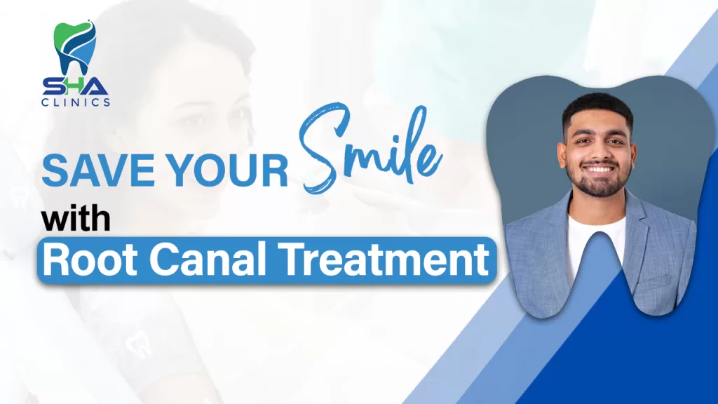 Save your smile with Root Canal Treatment