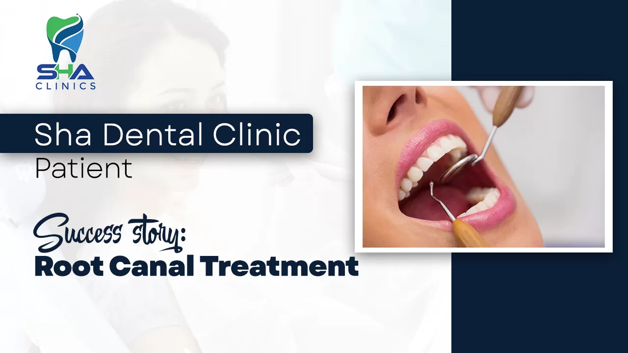 Sha Dental Clinic Patient Success Story: Root Canal Treatment