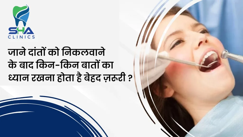 जाने दांतों को निकलवाने के बाद किन-किन बातों का ध्यान रखना होता है बेहद ज़रूरी ?
