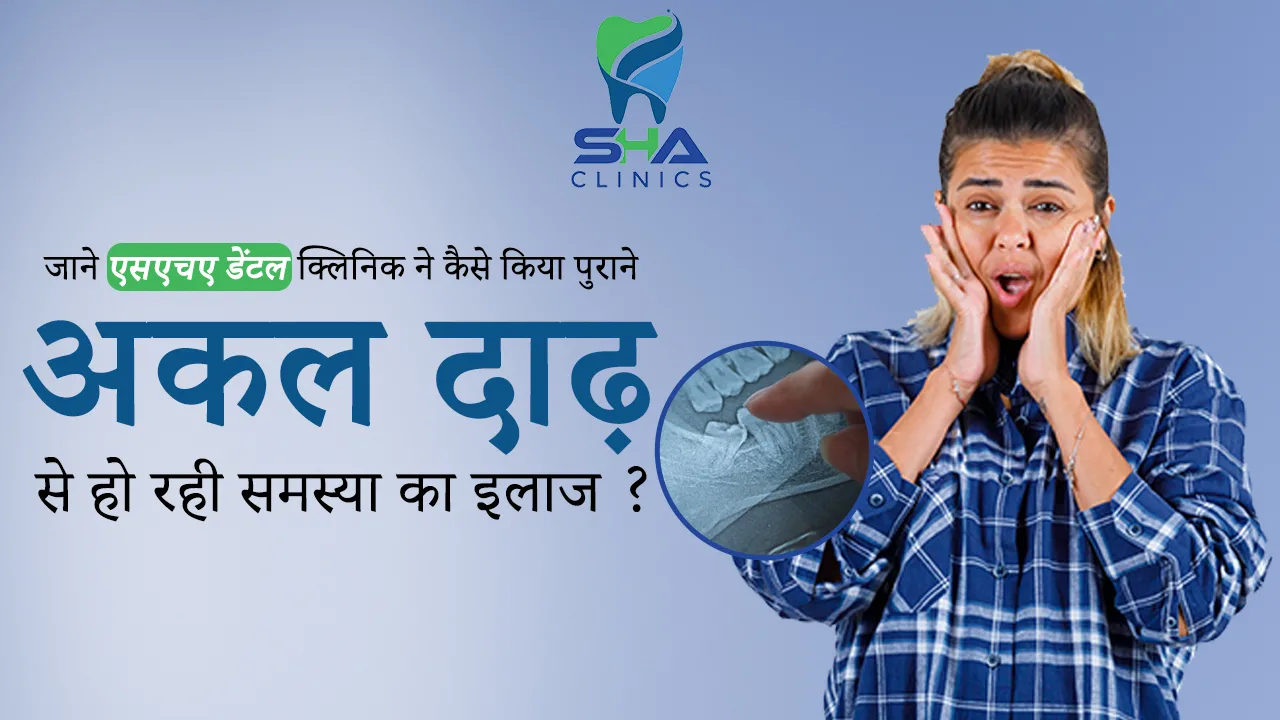 जाने कैसे किया पुराने अकल दाढ़ से हो रही समस्या का इलाज ?