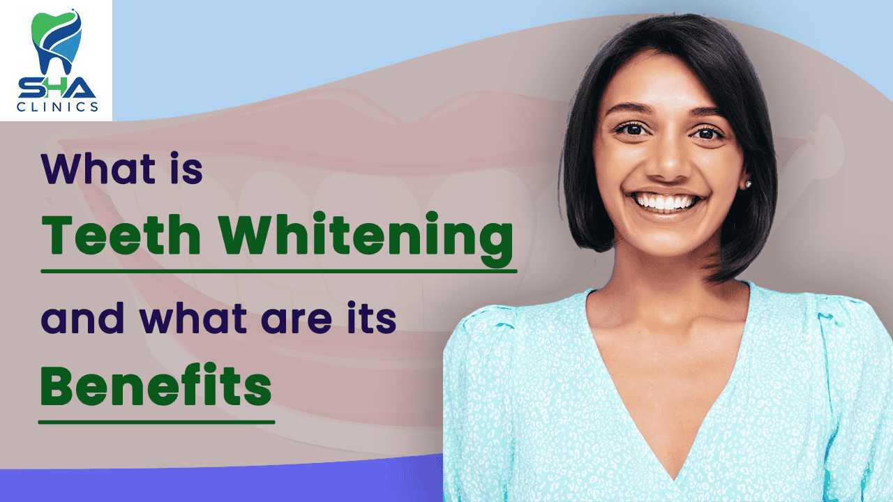 Transform Your Smile with Teeth Whitening at Sha Dental Clinics