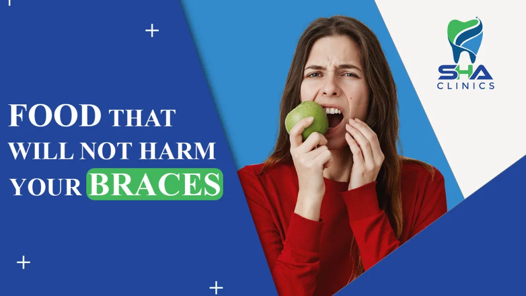 Foods That Are Safe and Delicious for Braces