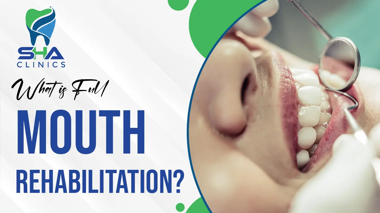 Why Full Mouth Rehabilitation Is Essential for Optimal Oral Health