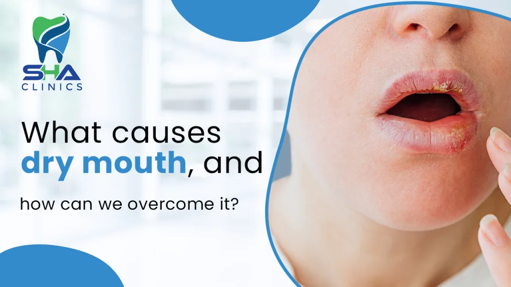 Dry Mouth Explained: Common Causes and How to Treat It
